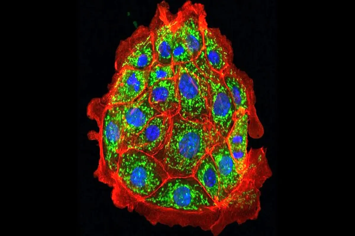 دانشمندان آسیب کلیوی را در موش‌ها معکوس کردند