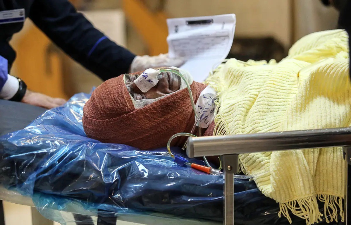 کمبود هزار تخت سوختگی در کشور