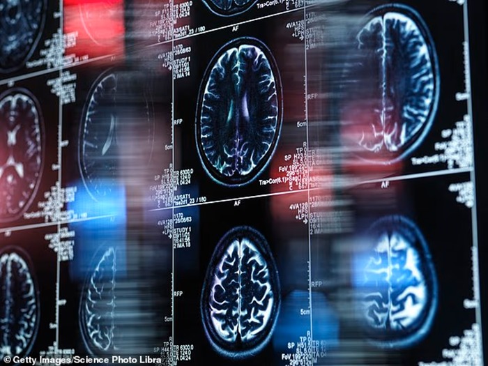 بیش از نیم میلیون نفر در بریتانیا با زوال عقل زندگی می‌کنند