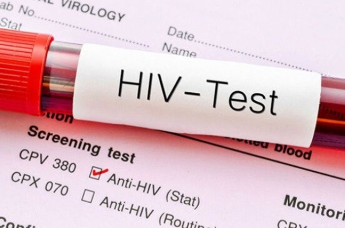 کاهش شیوع HIV در میان مصرف‌کنندگان تزریقی مواد مخدر