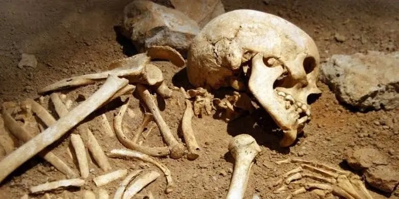 تصاویر مراحل تجزیه جسد انسان پس از مرگ +۱۸